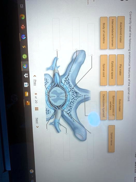 SOLVED: Body of vertebra intervertebral foramen Arachnoid mater