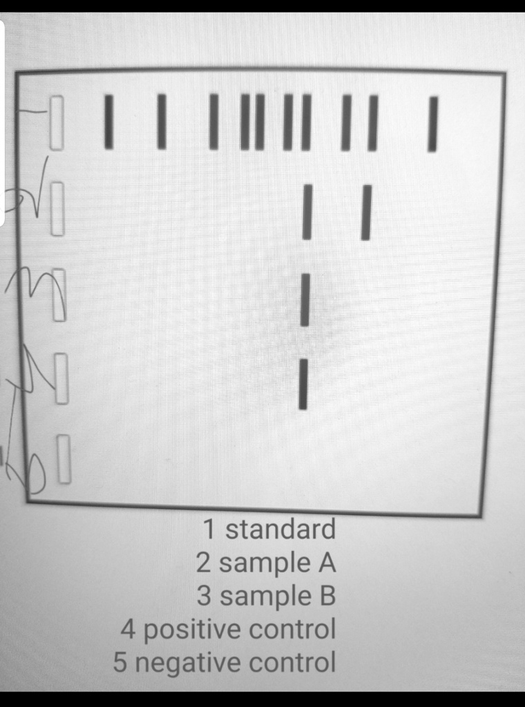 SOLVED: 'are there any problem in the result with this PCR experiment ...