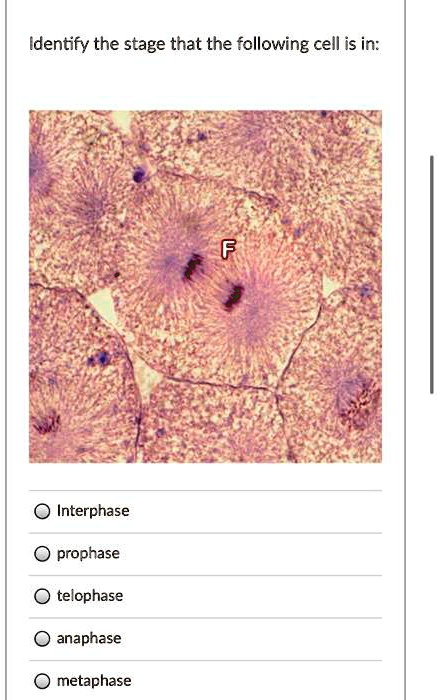 SOLVED: Identify the stage that the following cell is in: Interphase ...