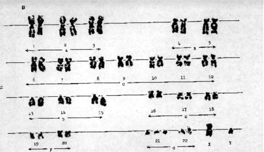 SOLVED: If You Look Closely At The Chromosomes In Karyotype B Versus ...