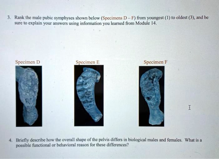 VIDEO solution Rank the male pubic symphyses shown below (Specimens D