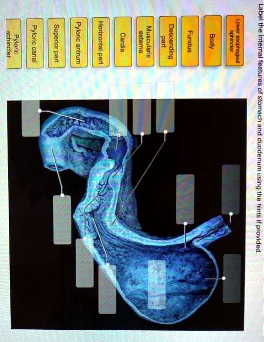 SOLVED: sphincter Pyloric Pyloric canal Superior part Pyloric antrum ...