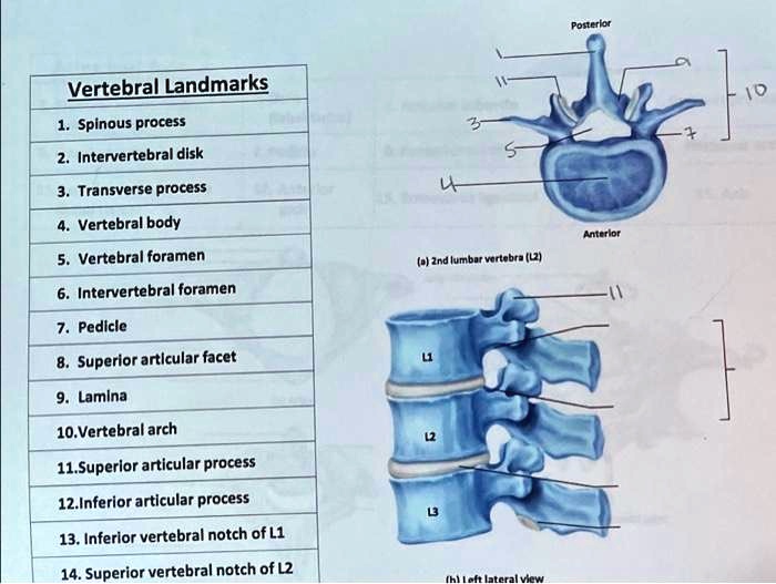 Solved: Texts: Vertebral Landmarks 1. Spinous Process 2. Intervertebral 