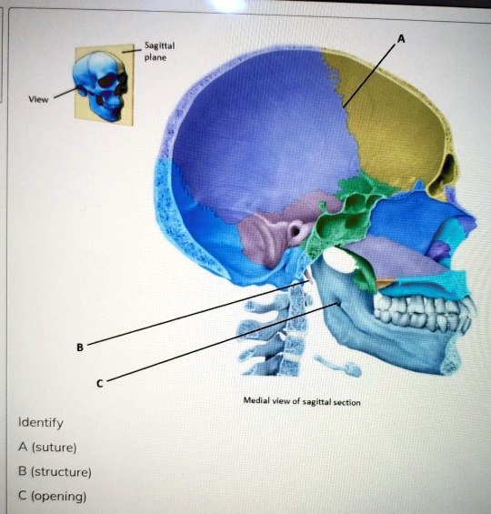 Sagittal plane Medial view of sagittal section Identify A (suture) B ...