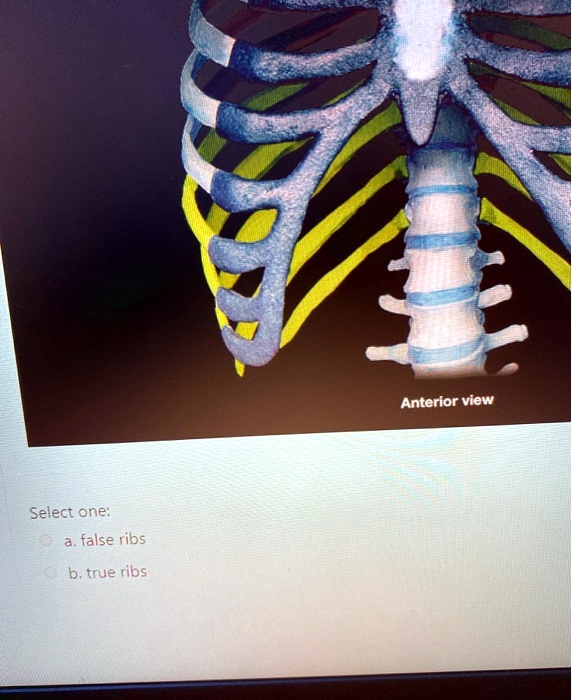 anterior view select one false ribs true ribs 11416