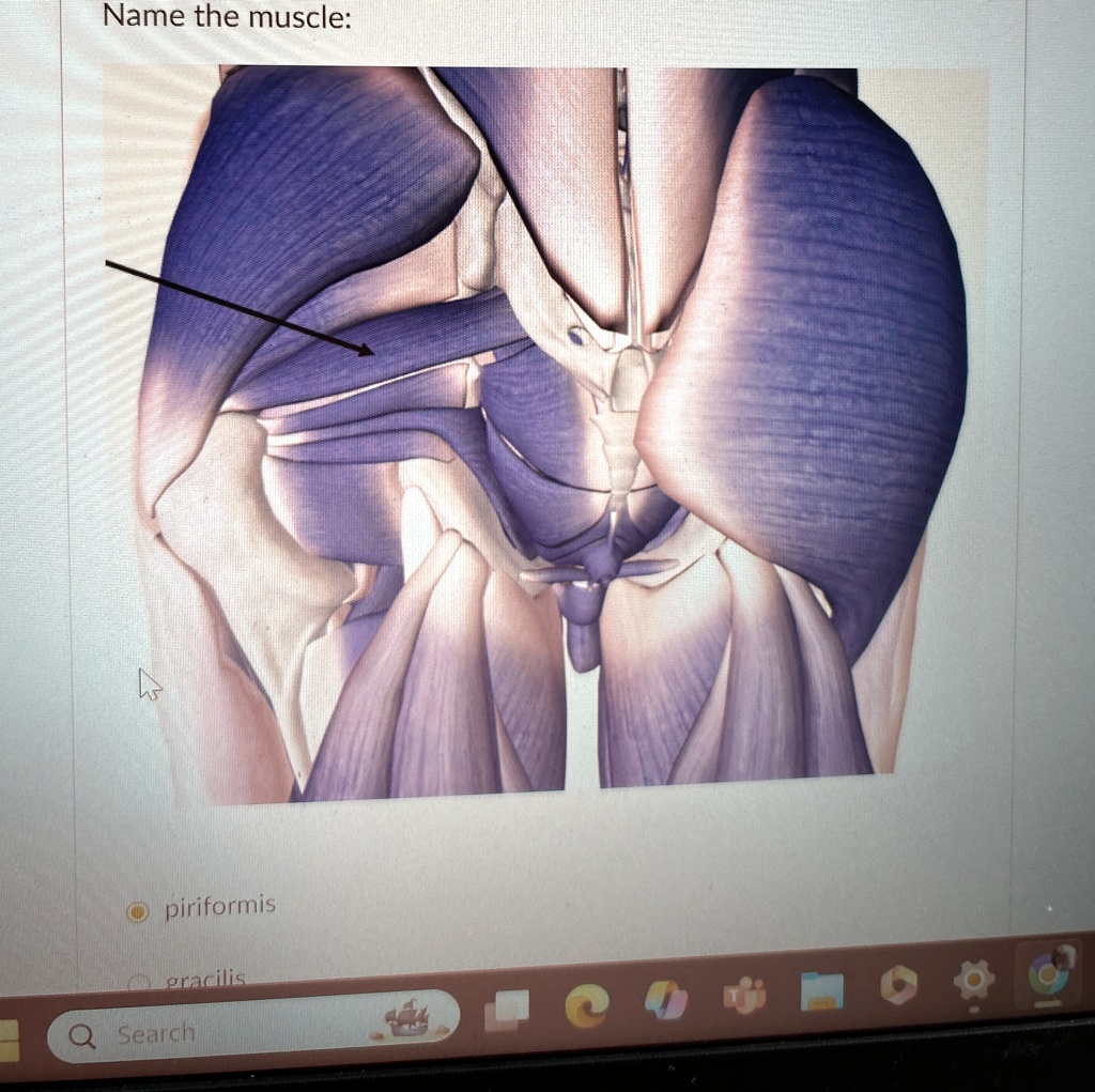 Name the muscle:

piriformis
gracilis