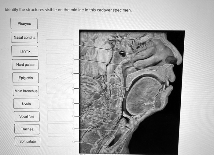 SOLVED: Identify the structures visible on the midline in this cadaver ...