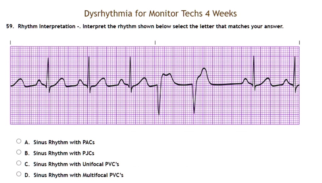 SOLVED: 59. Rhythm Interpretation - Interpret the rhythm shown below ...