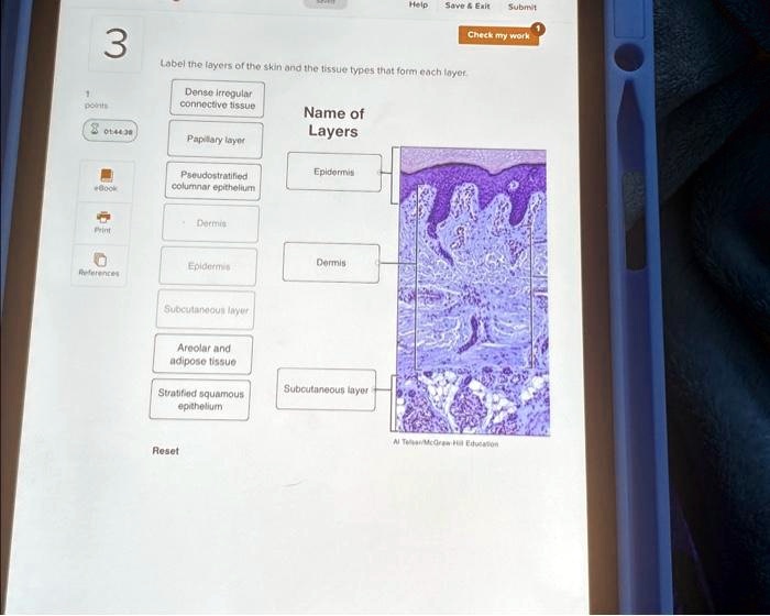 SOLVED: 3. Label the layers of the skin and the tissue types that form ...