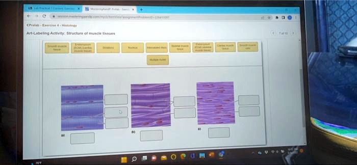 SOLVED: Art-Labeling Activity: Structure of Muscle Tissue TH10