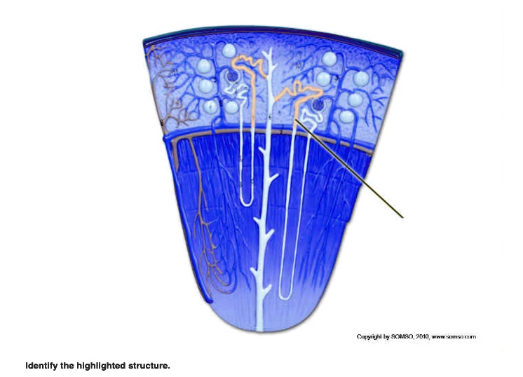 SOLVED: Lab 15: Urinary System. pyigl by SOMSO, D10wwwn Identify the