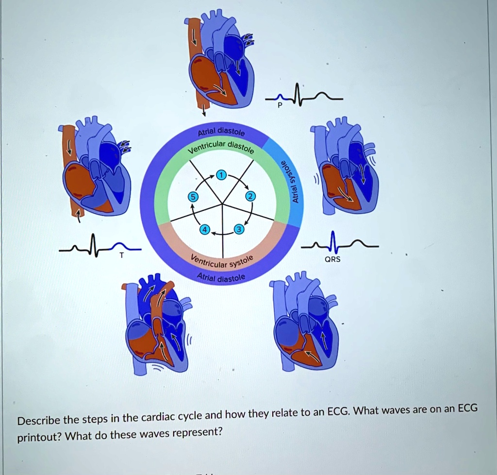 Atrial diastole Ventricular diastole Ventricular systole Atrial ...