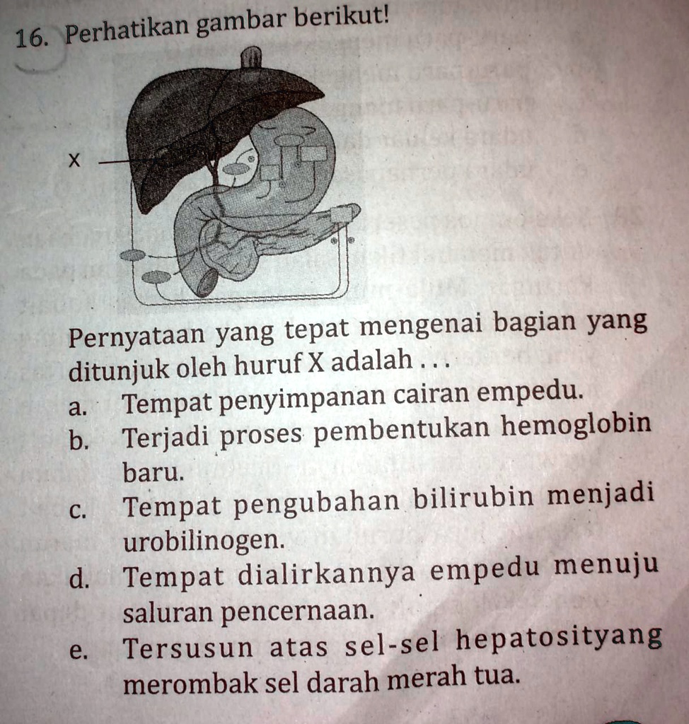 SOLVED: Perhatikan Gambar Berikut! Pernyataan Yang Tepat Mengenai ...