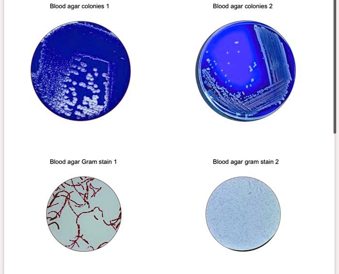 solved-genus-and-species-for-positive-and-negative-blood-agar-colonies-blood-agar-colonies