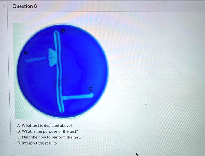 SOLVED Question 8 Whal test is depicted above? B. What is the purpose
