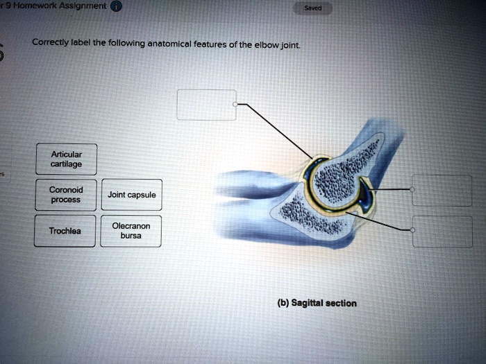 SOLVED Homework Assignment Correctly label the following anatomical