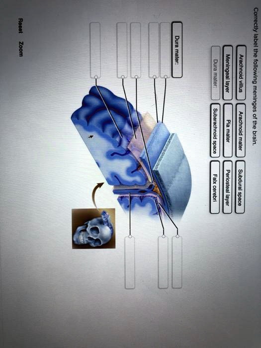 SOLVED: Dura mater Meningeal layer Arachnoid villus Subarachnoid space ...