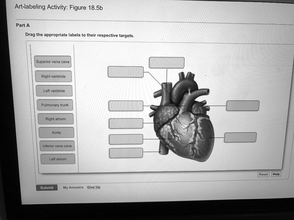 SOLVED: Art-labeling Activity: Figure 18.5b Part A Drag the appropriate ...