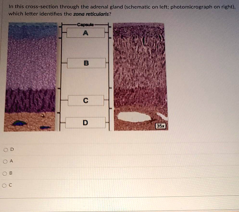 In this cross-section through the adrenal gland (schematic on left; photomicrograph on right),
which letter identifies the zona reticularis?
Capsule
A
OD
OA
OB
OC
B
C
D
35x