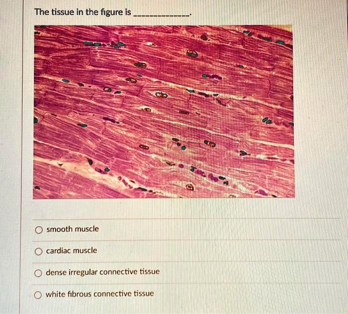 Solved The Tissue In The Figure Is Smooth Muscle Cardiac Muscle