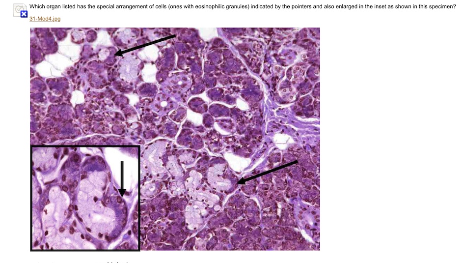 SOLVED pancreas, submandibular gland, brunner's gland Which organ listed has the special