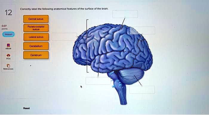 SOLVED: Correctly label the following anatomical features of the