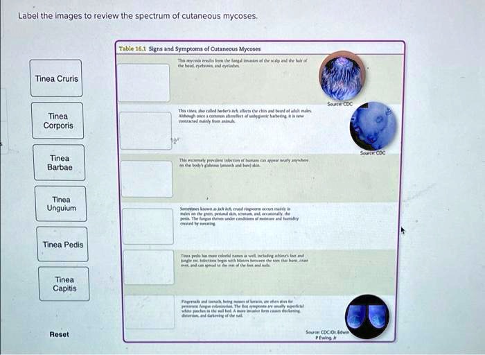 Solved: Label The Images To Review The Spectrum Of Cutaneous Mycoses 