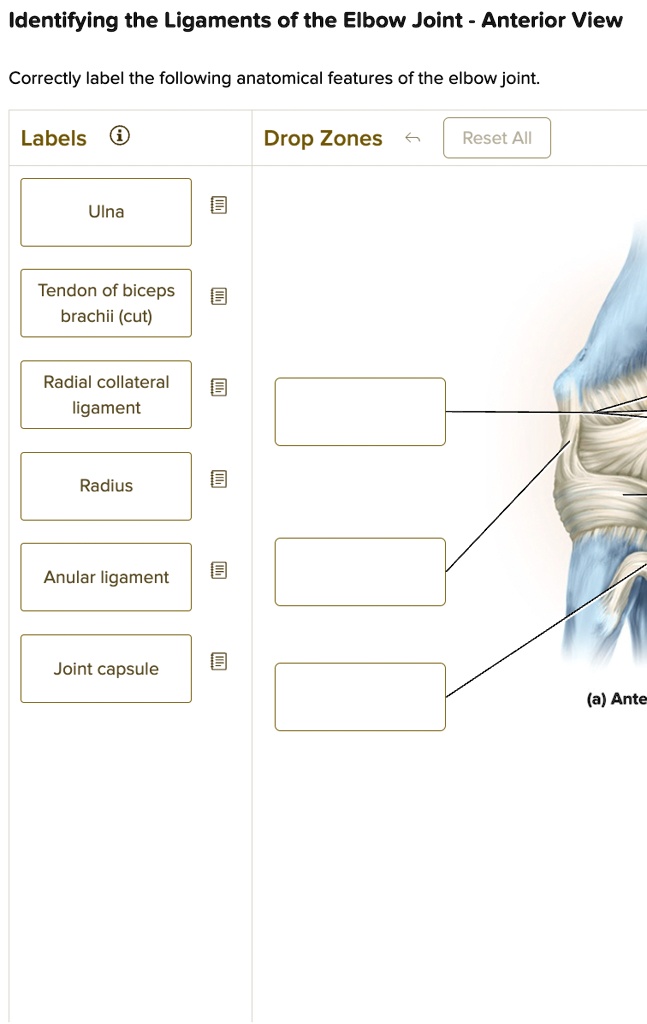 Correctly Label The Following Supportive Ligaments. SOLVED: Correctly label the following anatomical features of the elbow
