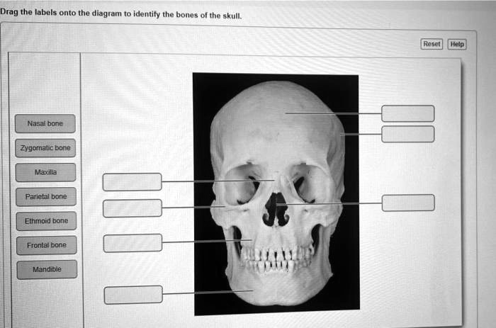 SOLVED: Drag the labels onto the diagram to identify the bones of the ...