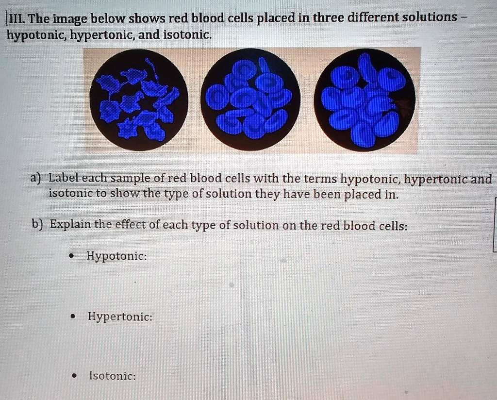 SOLVED: III. The image below shows red blood cells placed in three ...