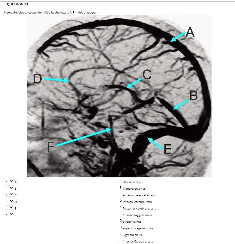 SOLVED: QUESTION 13 Name the blood vessels identified by the letters A ...