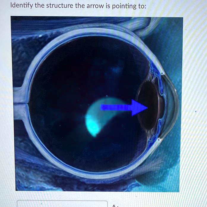 SOLVED Identify the structure the arrow is pointing to
