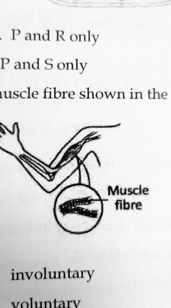 SOLVED: 'The Muscle Fibre Shown In The Diagram Is: Muscle Fibre A ...