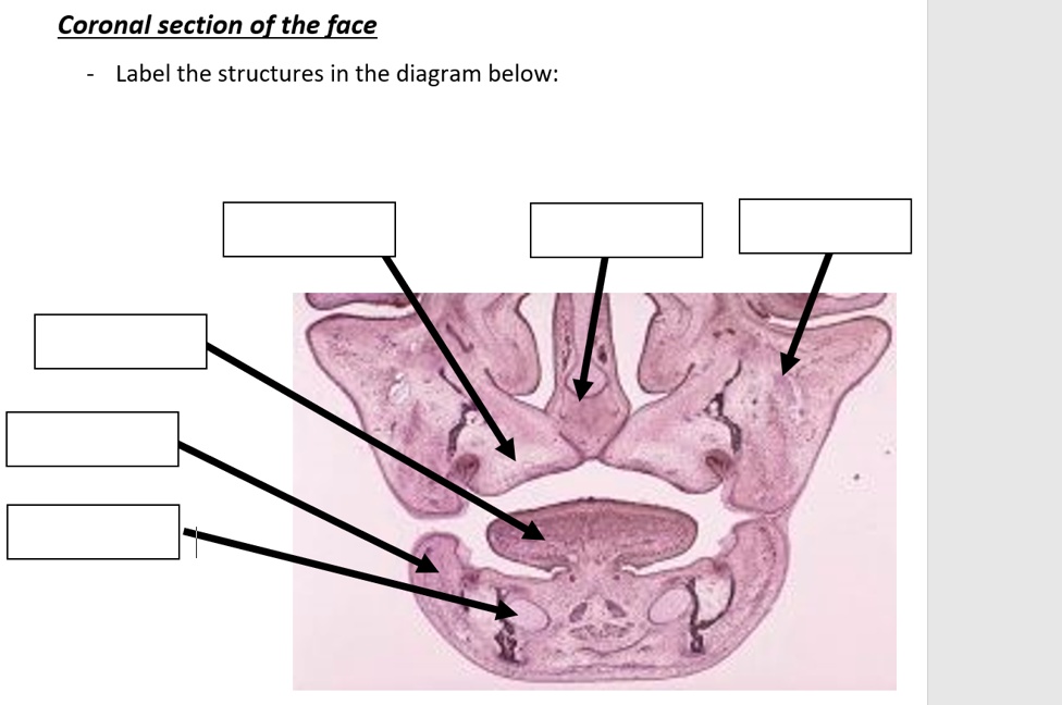 SOLVED: Coronal section of the face Label the structures in the diagram ...