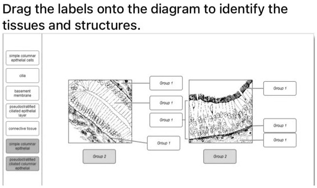 Simple Columnar With Label Drag the labels onto the diagram to identify the tissues and structures ...