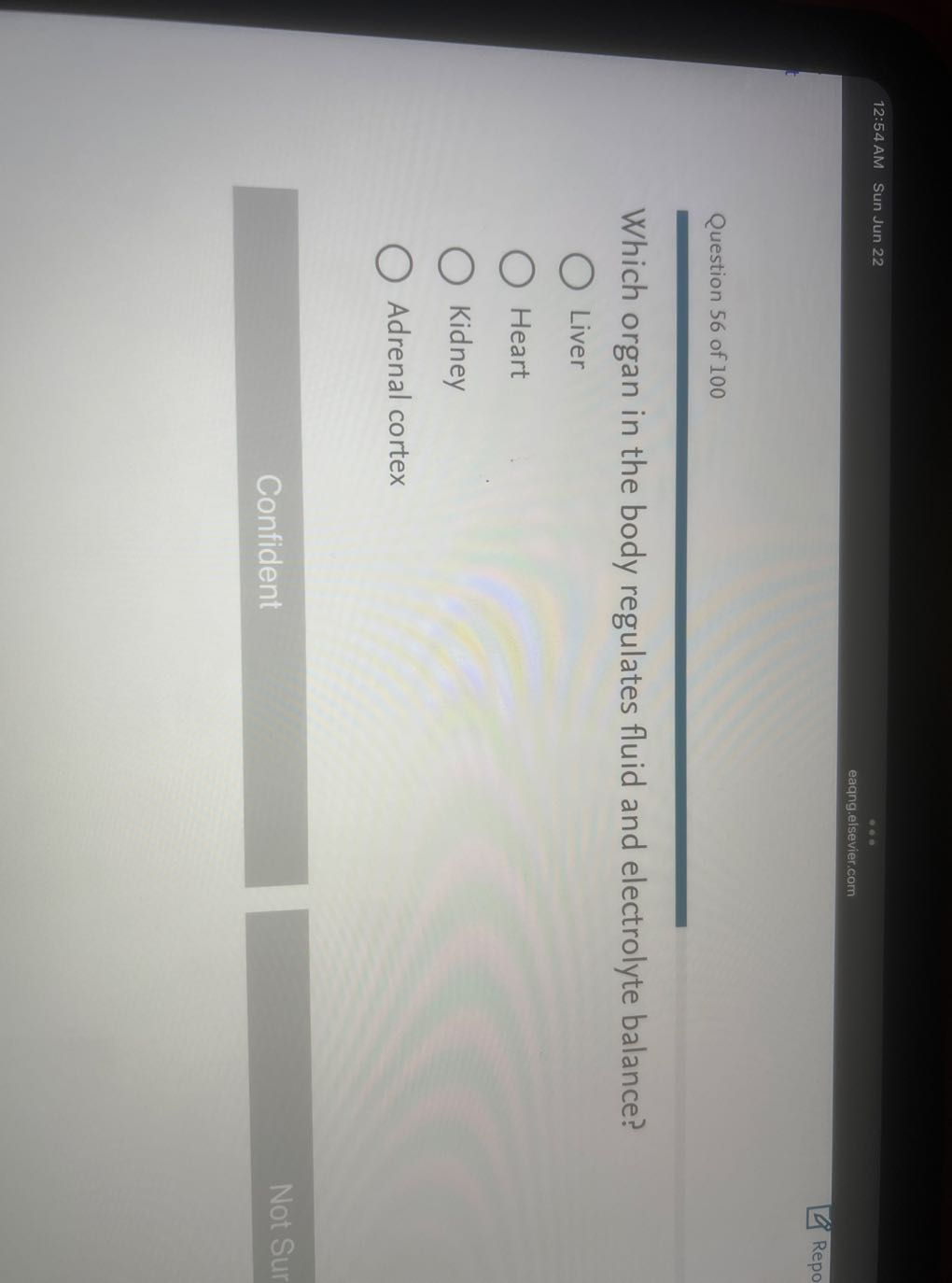 12:54 AM Sun Jun 22
eaqng.elsevier.com
Repo

Question 56 of 100

Which organ in the body regulates fluid and electrolyte balance?
Liver
Heart
Kidney
Adrenal cortex
Confident
Not Sur