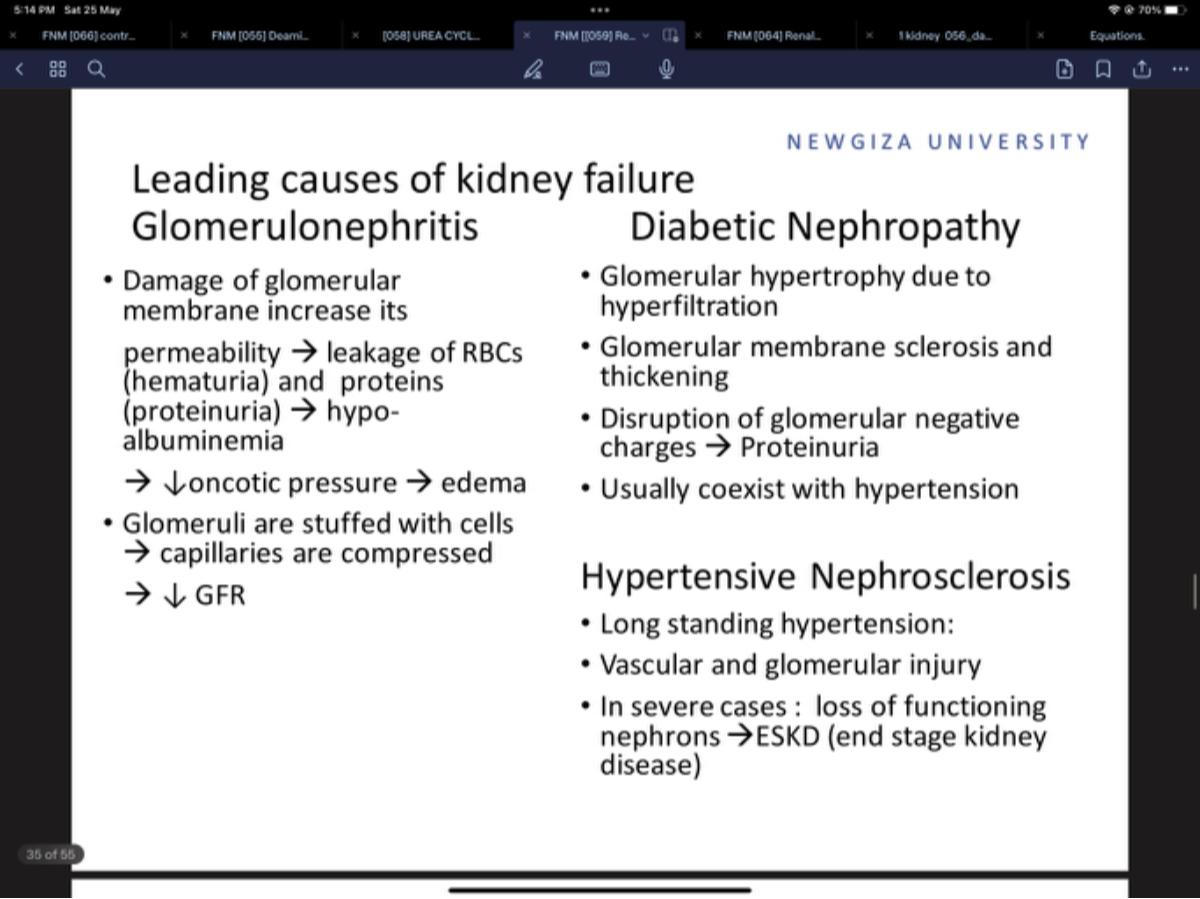 NEWGIZA UNIVERSITY Leading causes of kidney failure Glomerulonephritis ...