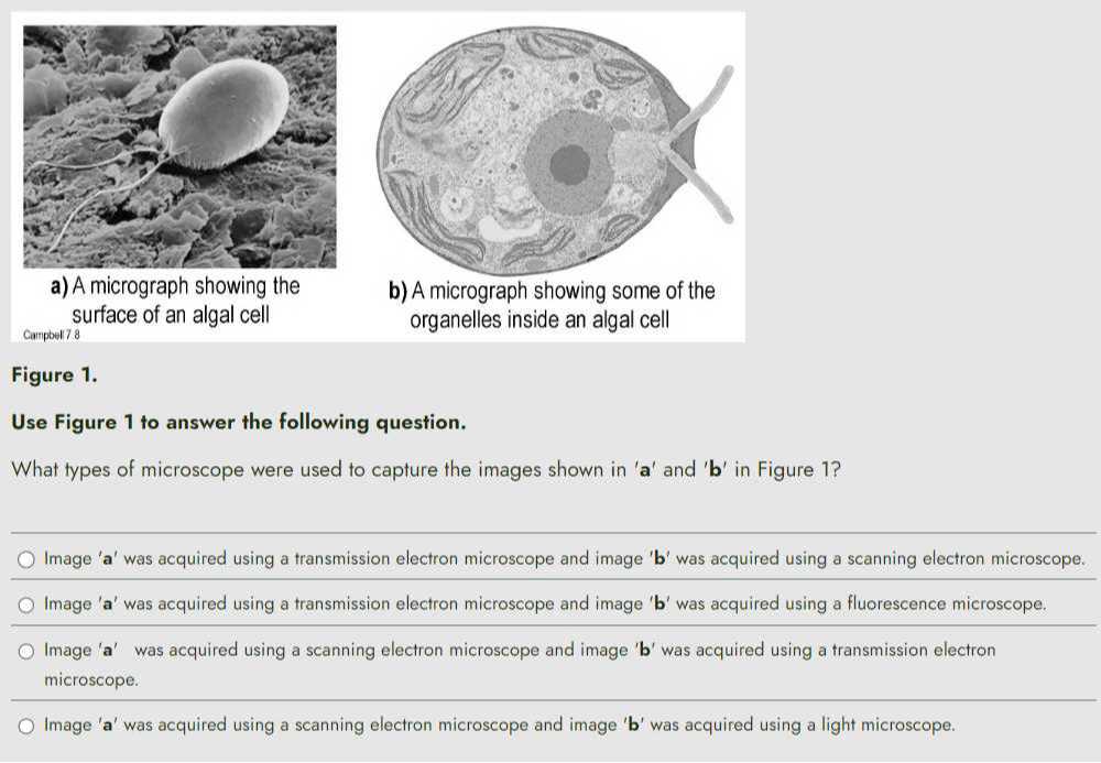 a) A micrograph showing the surface of an algal cell Campbell 78 b) A ...