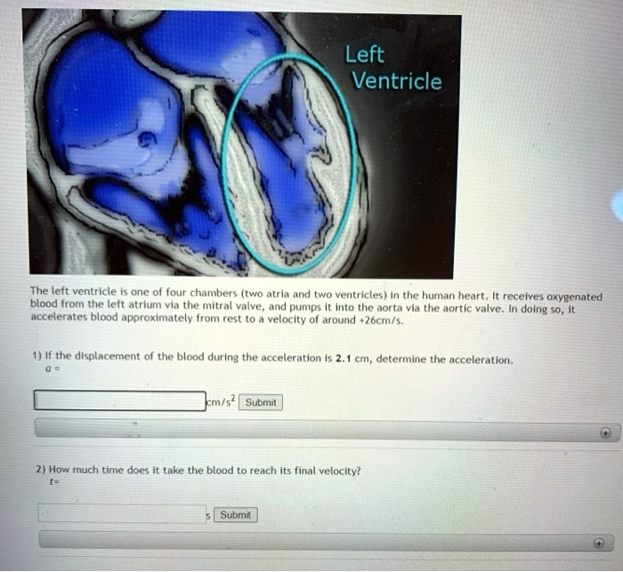 SOLVED:Left Ventricle The left ventrIcle onc 0i four chambers (two ...