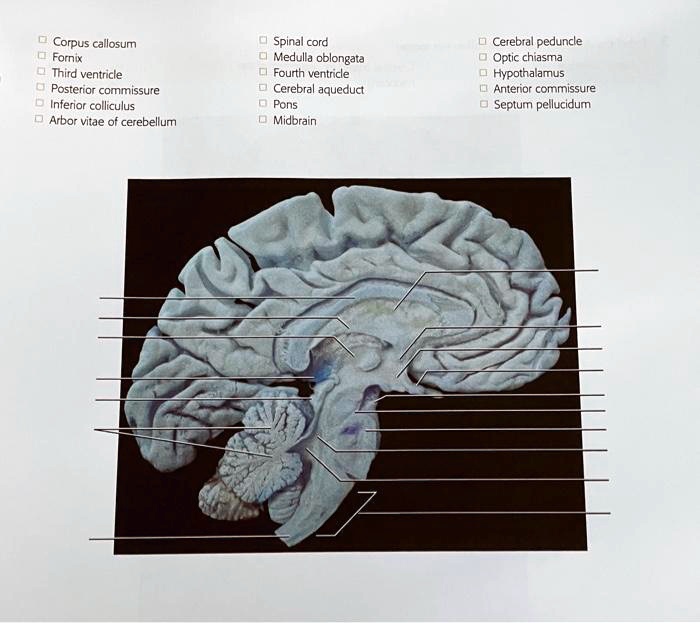 Solved Corpus Callosum Fornix Third Ventricle Posterior Commissure