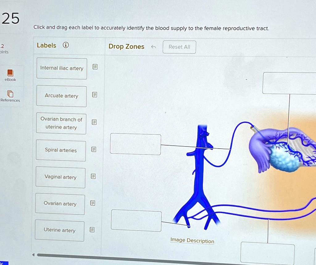 VIDEO solution 25 Click and drag each label to accurately identify the