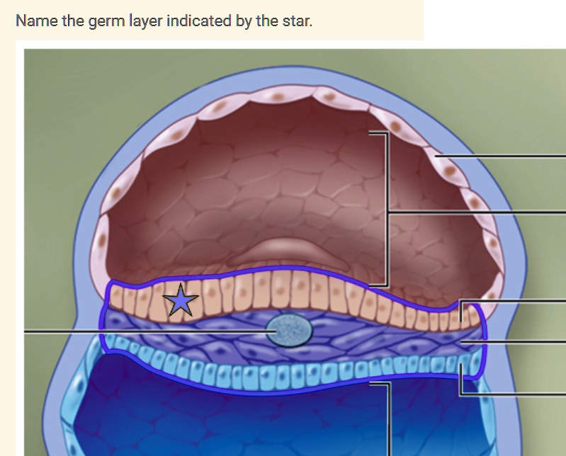 Solved A Endoderm B Ectoderm C Epidermis D Mesoderm Name The Germ Solved A Endoderm B Ectoderm C Epidermis D Mesoderm Name The Germ