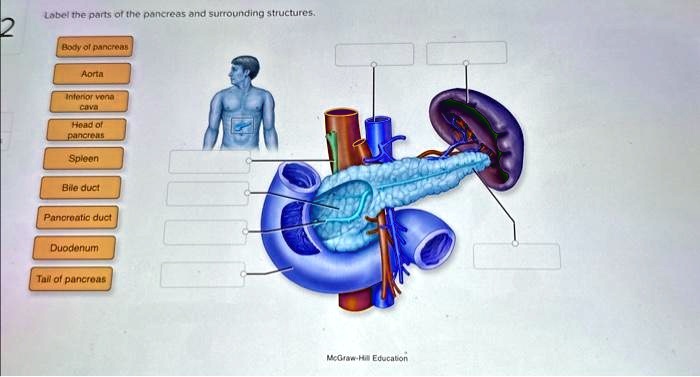 Texts: Label the parts of the pancreas and surrounding structures. Body ...