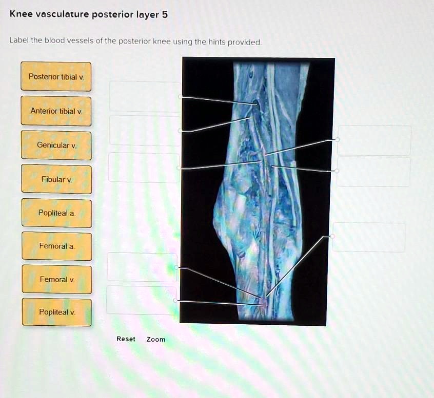 SOLVED Knee vasculature posterior layer Label the blood vessels of the