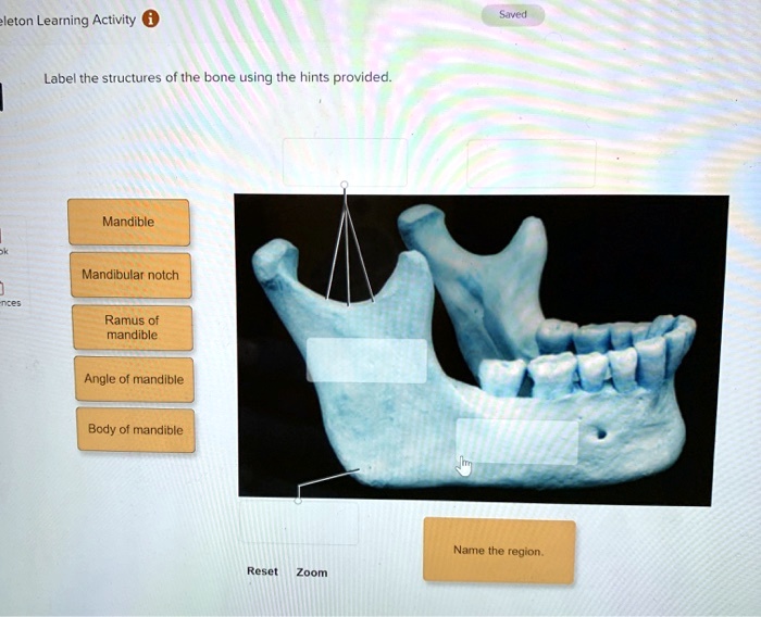 SOLVED leton Learning Activity Saved Label the structures of the bone