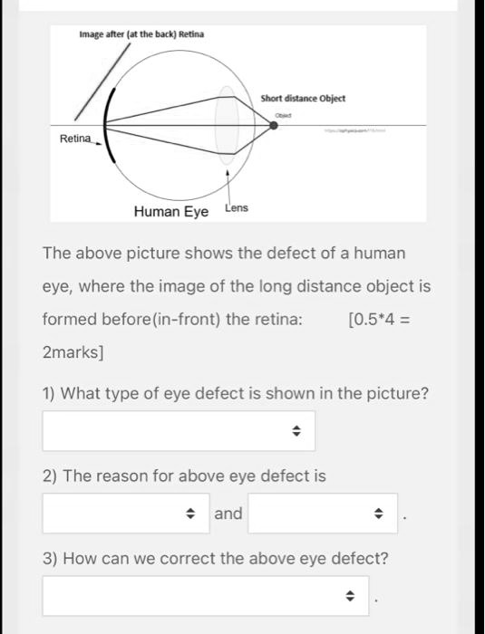 SOLVED:Image alter (at the back) Retina Short distance Oblect Relina ...