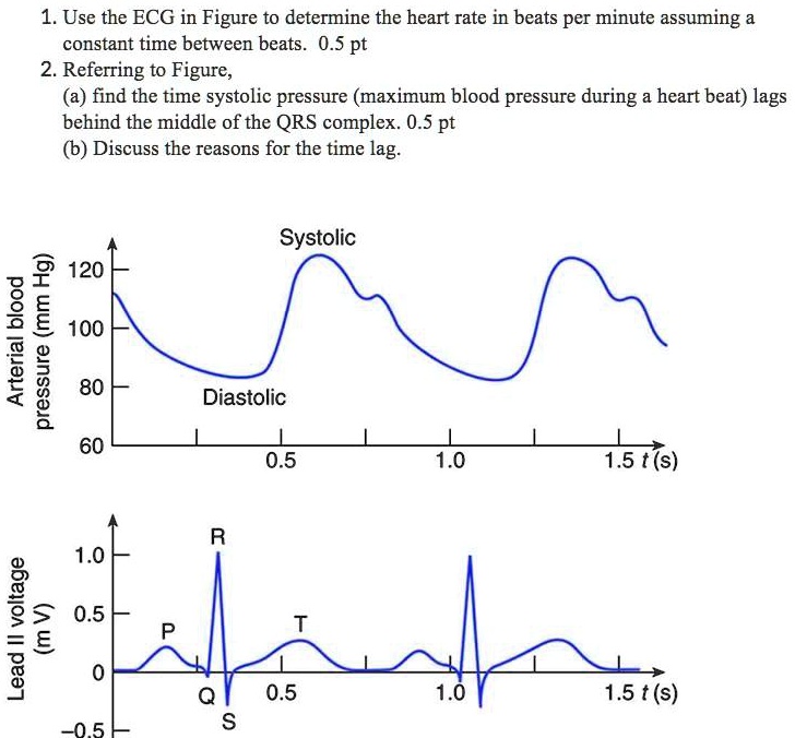 SOLVED:1. Use the ECG in Figure to determine the heart rate in beats ...