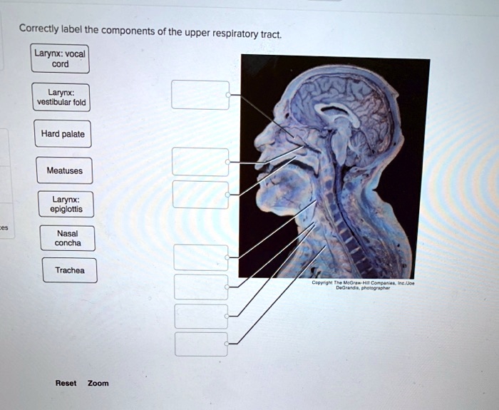 Solved Correctly Label The Components Of The Upper Respiratory Tract Larynx Vocal Cord Larynx