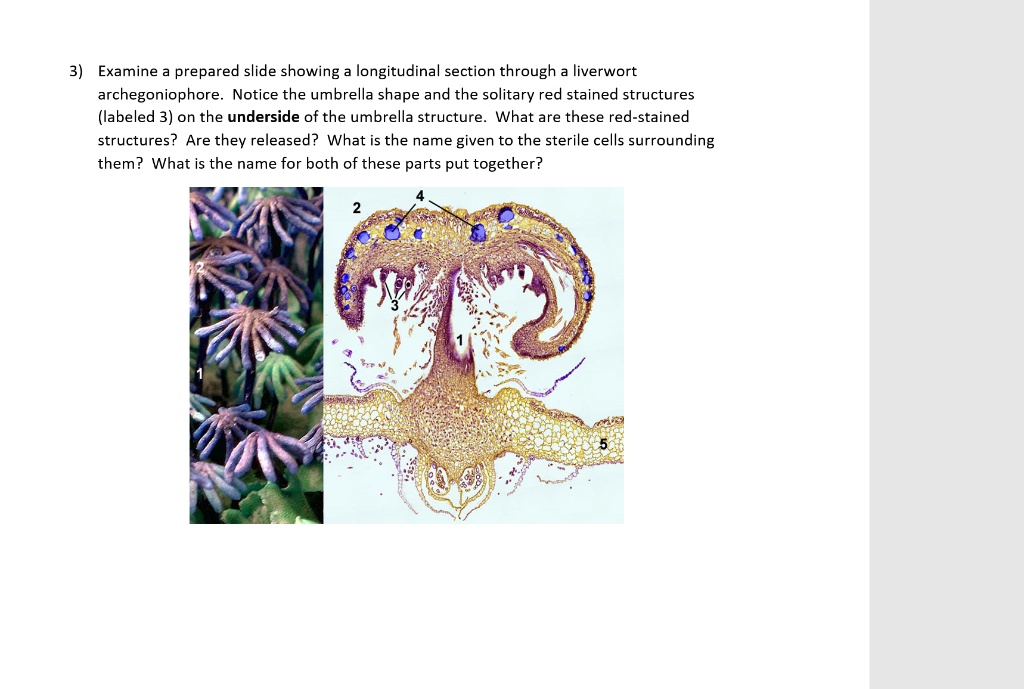 solved-examine-prepared-slide-showing-longitudinaba-ection-through