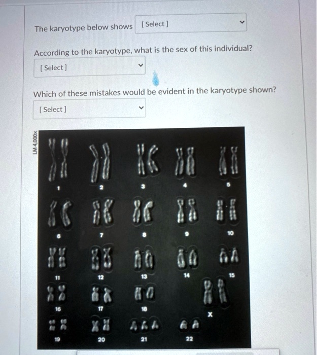 Solved: The Karyotype Below Shows Select ] According To The Karyotype 